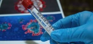 Coronavirus: 9 fallecimientos y 534 nuevos casos