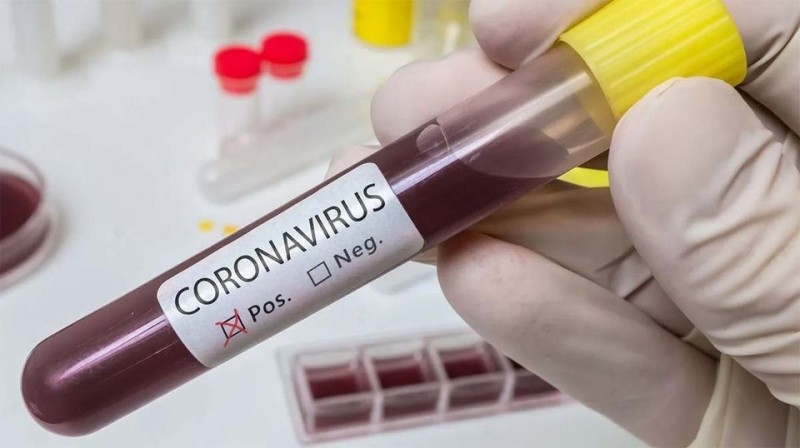 Confirman nueva defunción por coronavirus
