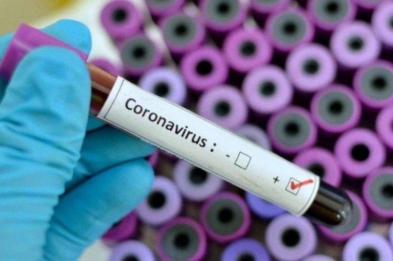 Coronavirus: 812 muertos y más 37.000 infectados