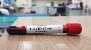 6 nuevas defunciones y 519 casos detectados de coronavirus